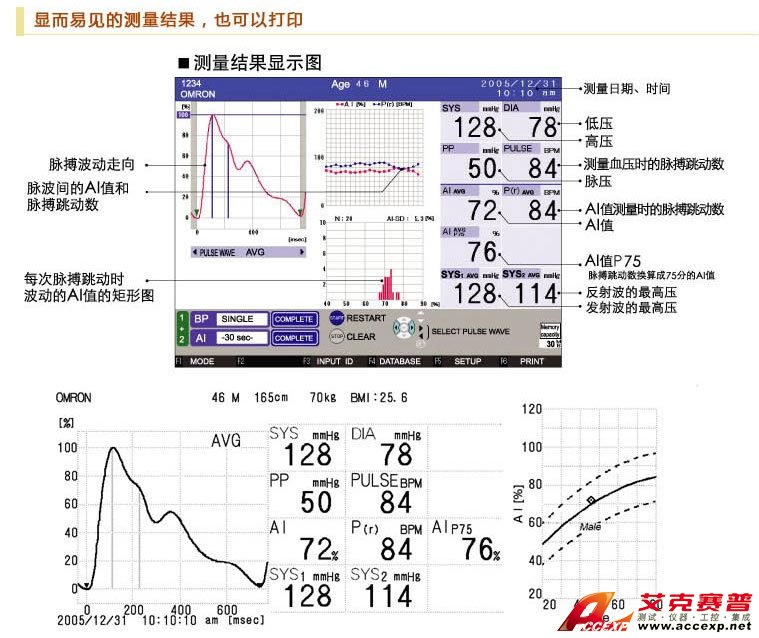 显而易见的动脉结果